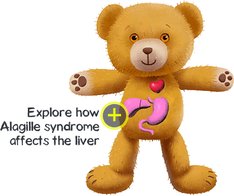Explore how Alagille syndrome affects the liver